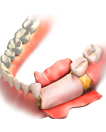 Cirurgia Reconstrutiva da face card