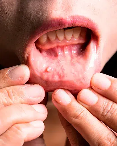 Cirurgia de tumores e cistos card