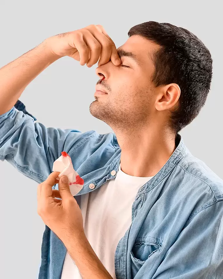 Sangramento nasal uai