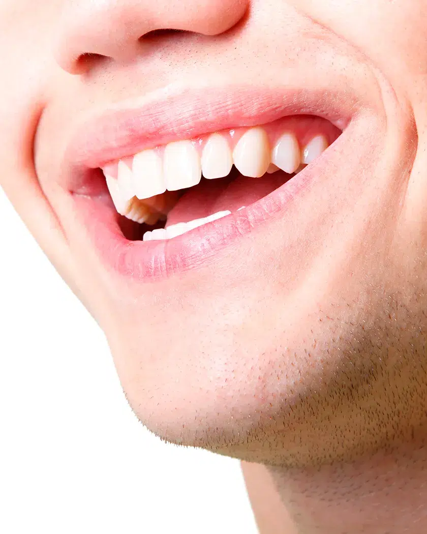 Sorriso bonito