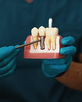 Implante dental